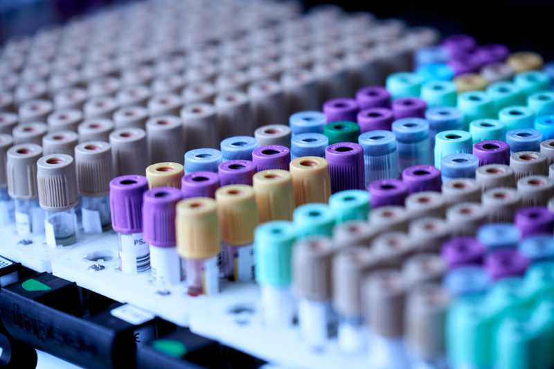 Testing Audit